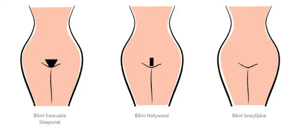 Depilacja laserowa bikini: Ile trwa? Pełny harmonogram i efekty