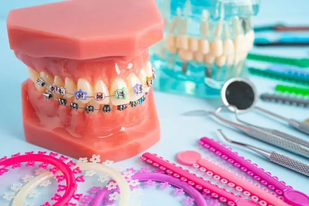 Ortodonta dla dziecka: 7 lat to klucz! Aparat ruchomy czy stały?