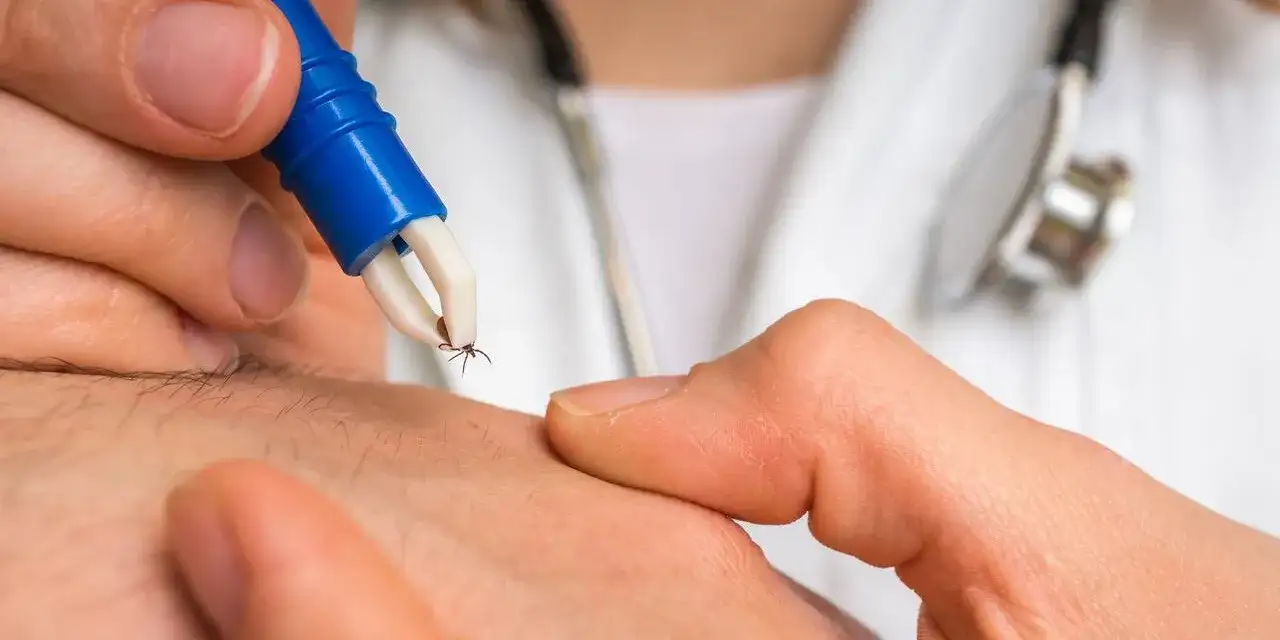 Borelioza: Ile zapłacisz za prywatne testy i co musisz wiedzieć?