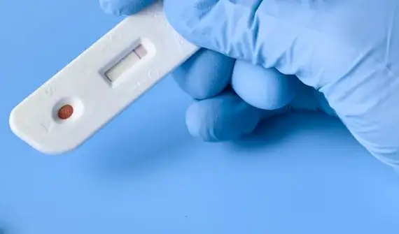 Co to jest CRP i ile kosztuje badanie - praktyczny poradnik 2025