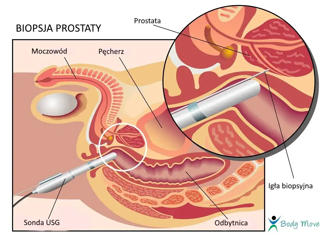 TRUS: Co to za badanie? Diagnostyka prostaty krok po kroku