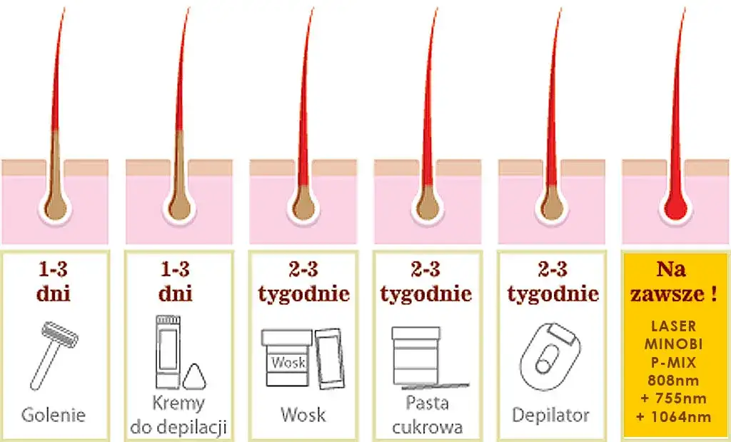 Co ile depilacja laserowa bikini? Sprawdź ceny i efekty zabiegów