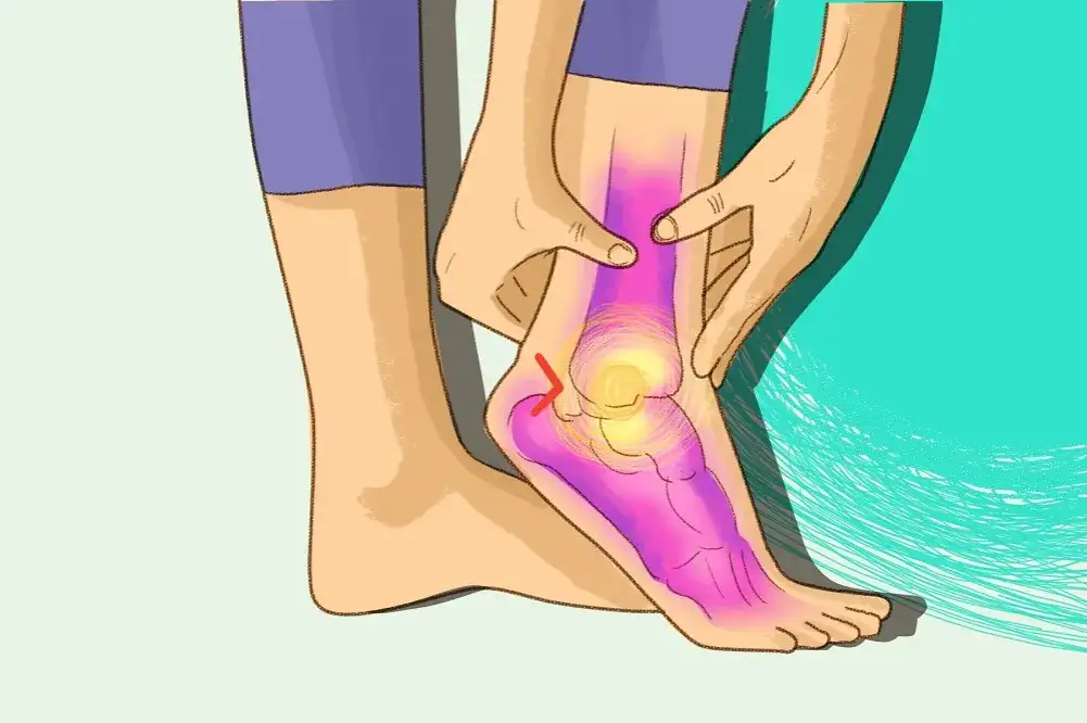 Skręcona kostka: Co robić po urazie? Od objawów do pełnej sprawności