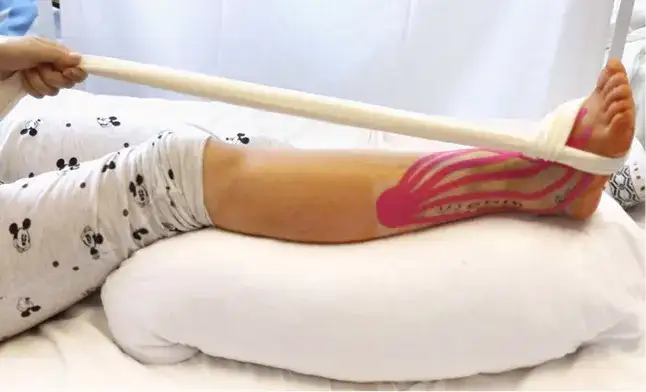 Co oznacza elewacja operowanej kończyny: praktyczne zasady unoszenia nogi