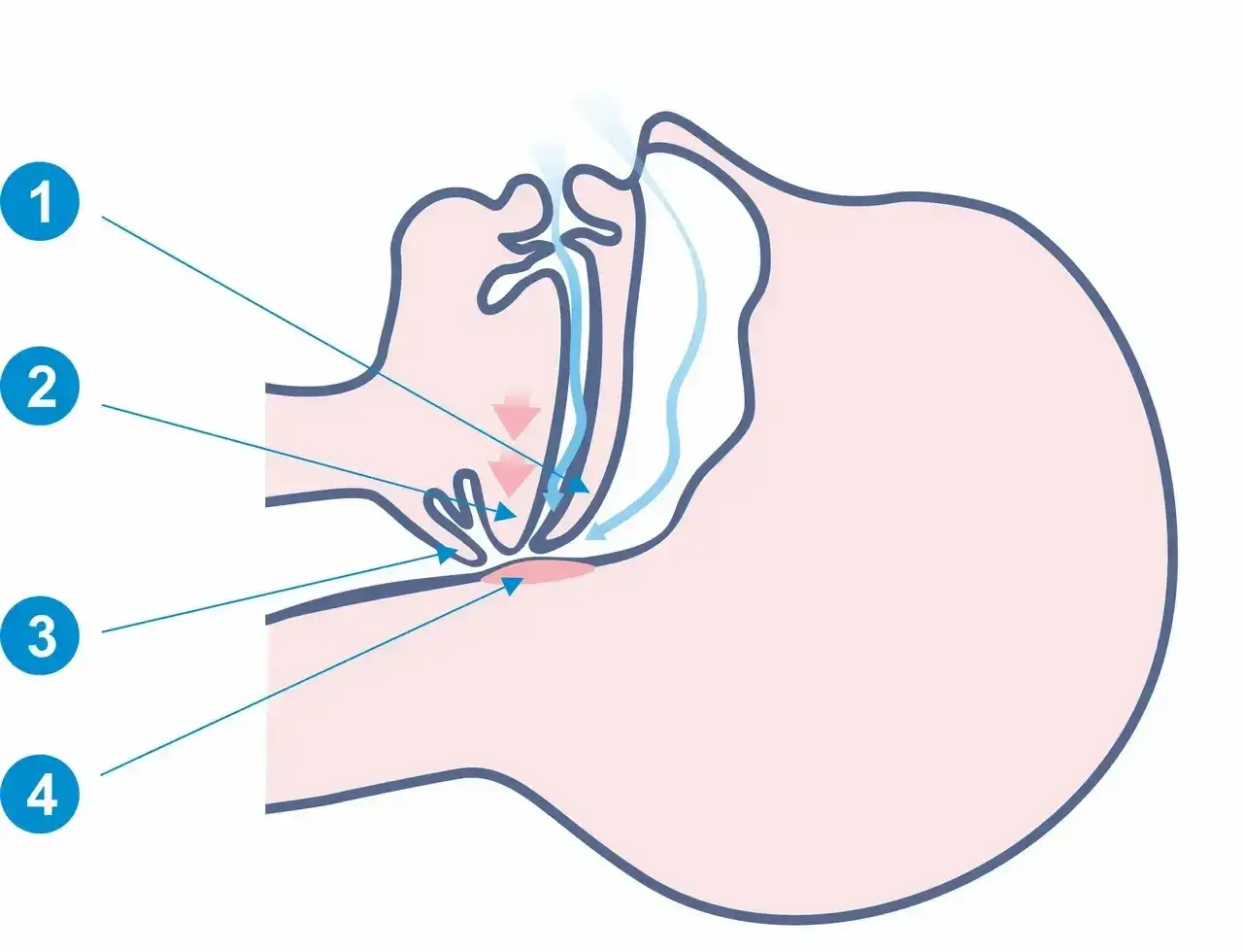 Chrapanie przyczyny: jakie są najczęstsze powody chrapania?
