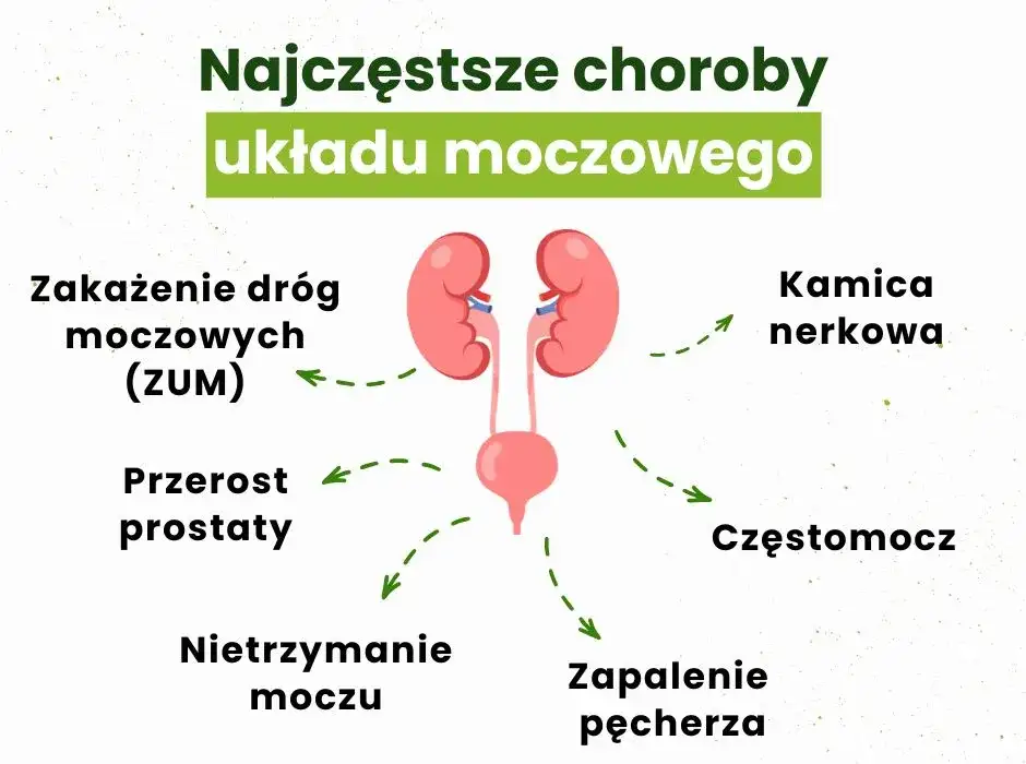 Najczęstsze objawy zapalenia pęcherza - na co zwrócić uwagę u siebie