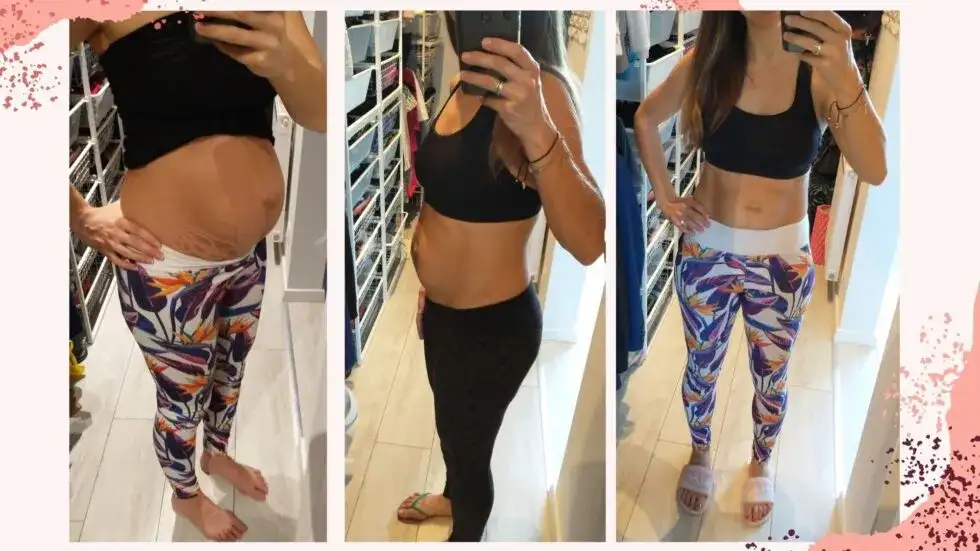 Kiedy po porodzie można ćwiczyć brzuszki, aby uniknąć problemów zdrowotnych?