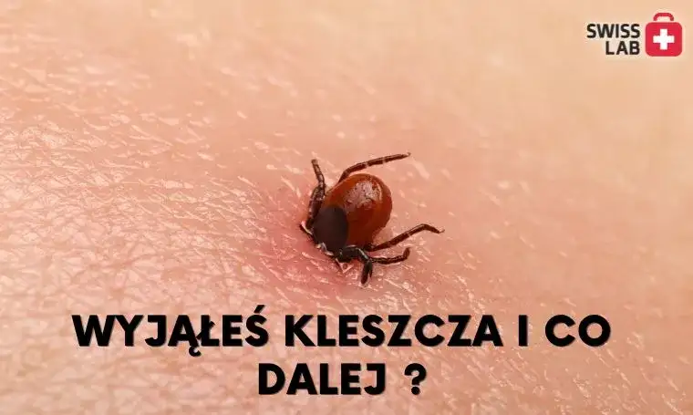 Jak sprawdzić, czy kleszcz wyszedł cały? Praktyczny poradnik