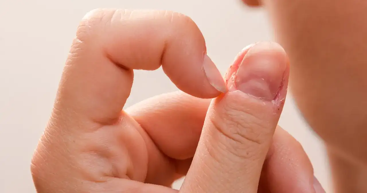 Jak wyglądają rozdwajające się paznokcie i jak je rozpoznać?