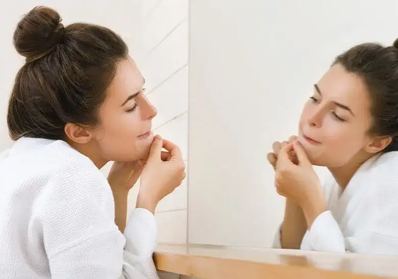 Czy wolno wyciskać pryszcze? Poznaj ryzyko i skutki dla skóry