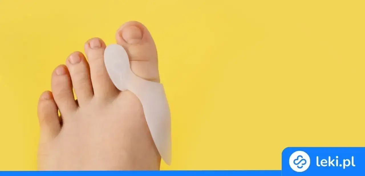 Jak wyleczyć haluksy? Kompleksowy poradnik od ćwiczeń po operację