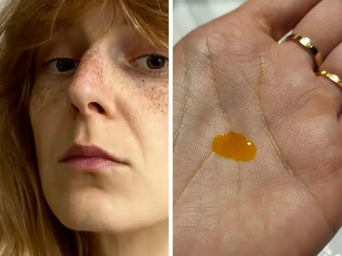 Twarz kobiety z piegami i kropla serum w dłoni.