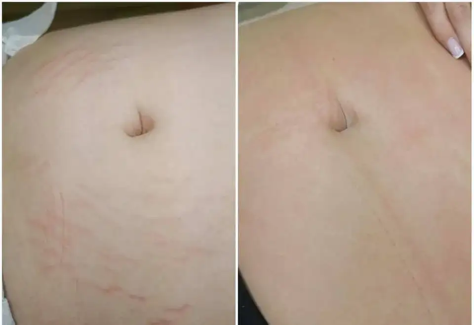 Gdzie kupić deep phyto peeling i uniknąć nieefektywnych produktów