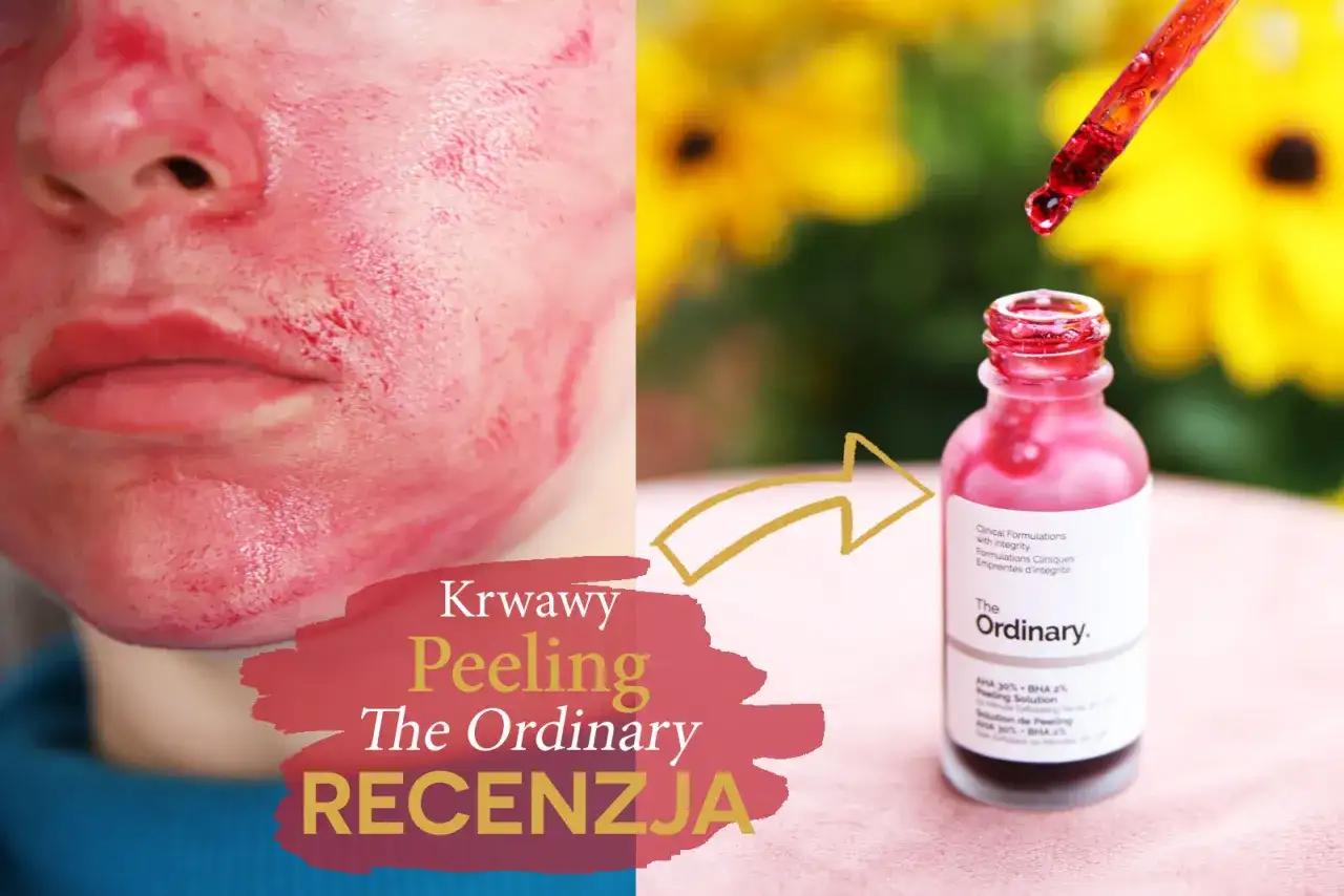 Krwawy peeling The Ordinary na twarzy i buteleczka z pipetką. Recenzja produktu.