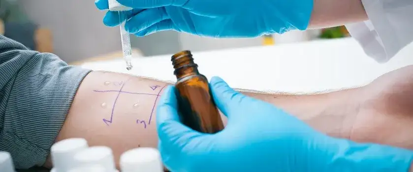 Gdzie zrobić testy alergiczne na leki i uniknąć nieprzyjemnych reakcji