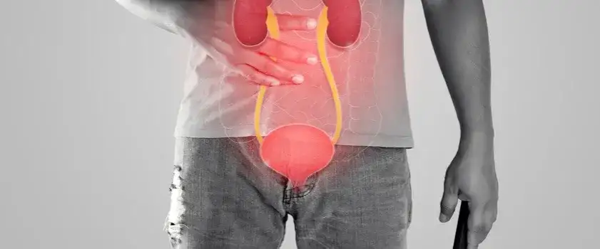 Ropa z cewki moczowej: objawy, przyczyny i jak skutecznie leczyć