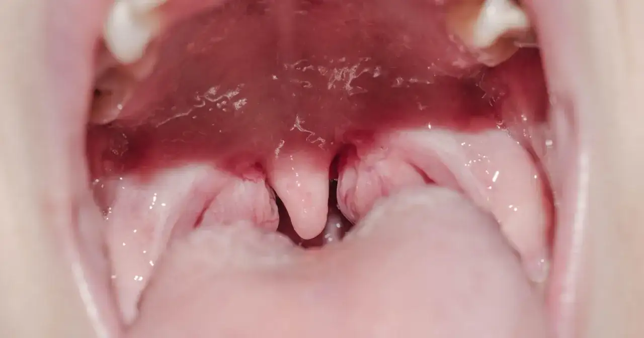 Jakie badania przed wycięciem migdałków? Kluczowe informacje i porady