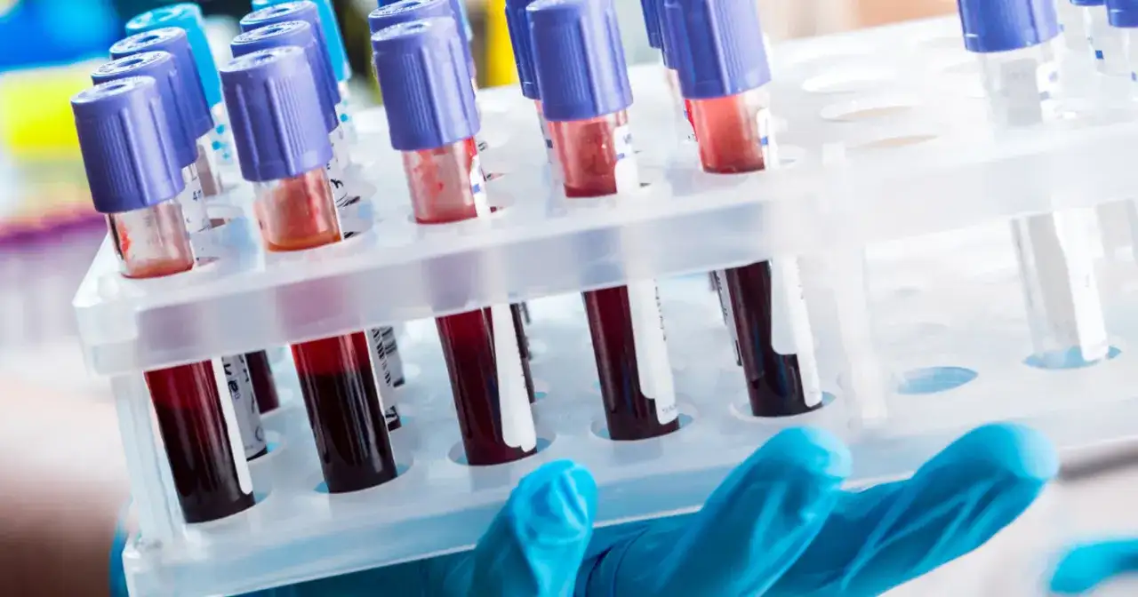 Diagnosta laboratoryjny i inni: Kto odpowiada za Twoje wyniki?