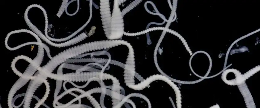 Tasiemiec psi u człowieka: 5 objawów których nie przegap