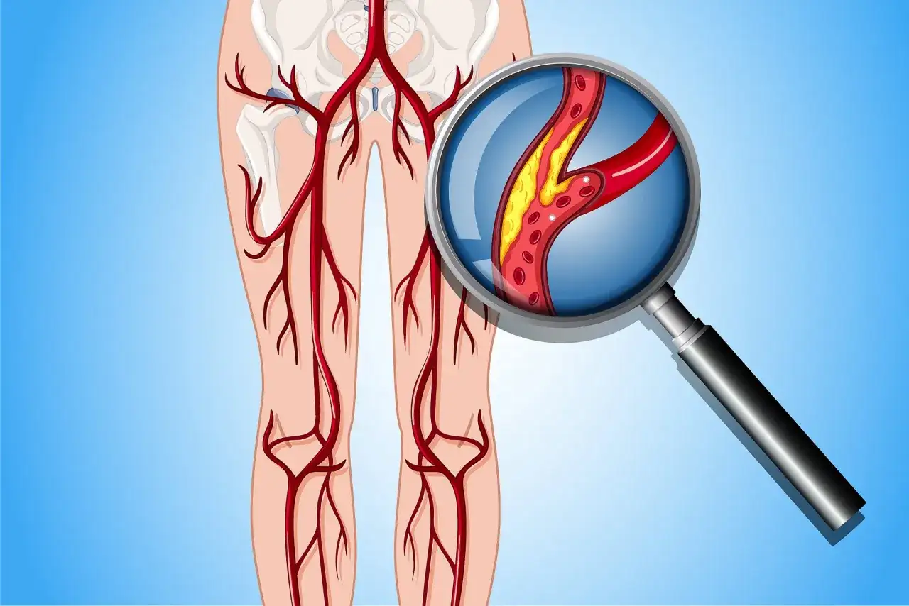 Wichtige Diagnosetechniken der peripheren arteriellen Verschlusskrankheit