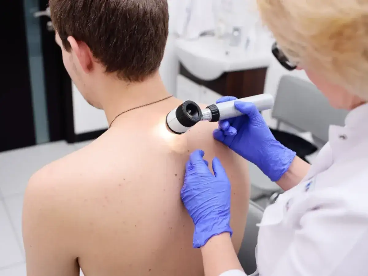 Tłuszczak do jakiego lekarza? Sprawdź, jak uzyskać pomoc medyczną