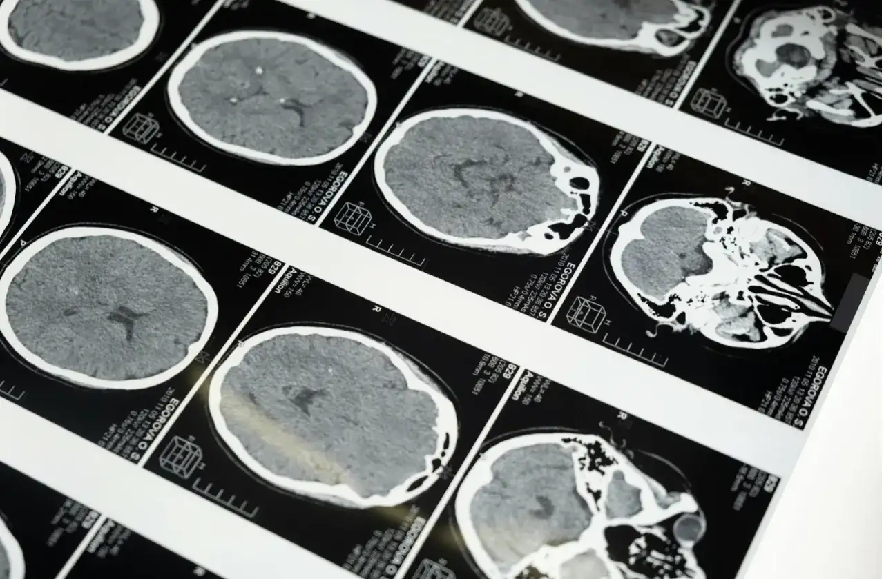 Teleradiologia – jak działa i dlaczego coraz częściej zastępuje tradycyjne opisy badań?