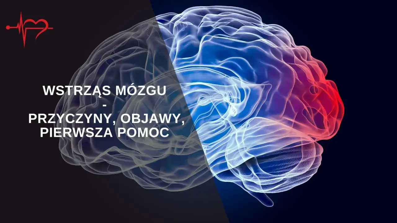 Wstrząśnienie mózgu objawy: co musisz wiedzieć o skutkach urazu głowy