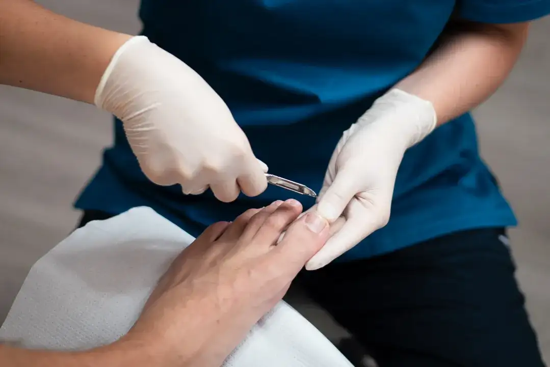 Masz problem z bólem stóp lub wrastającymi paznokciami? Zobacz, co poleca sprawdzony sklep podologiczny