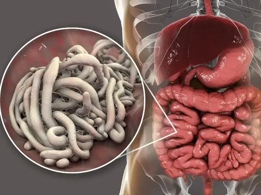 Skąd się biorą owsiki? Jak unikać zakażeń i chronić dzieci przed nimi
