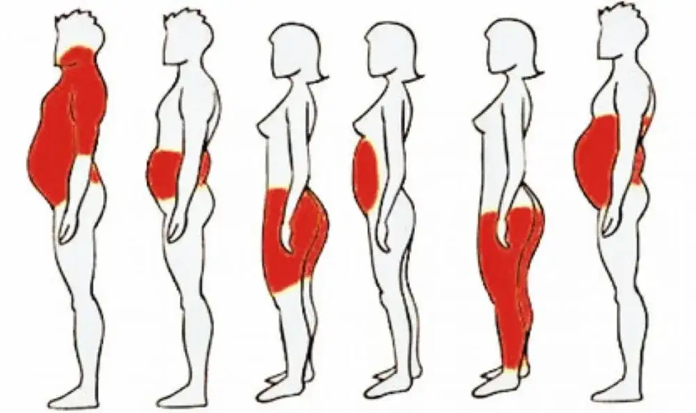 Otyłość trzewna: rozpoznawanie i metody skutecznego leczenia.