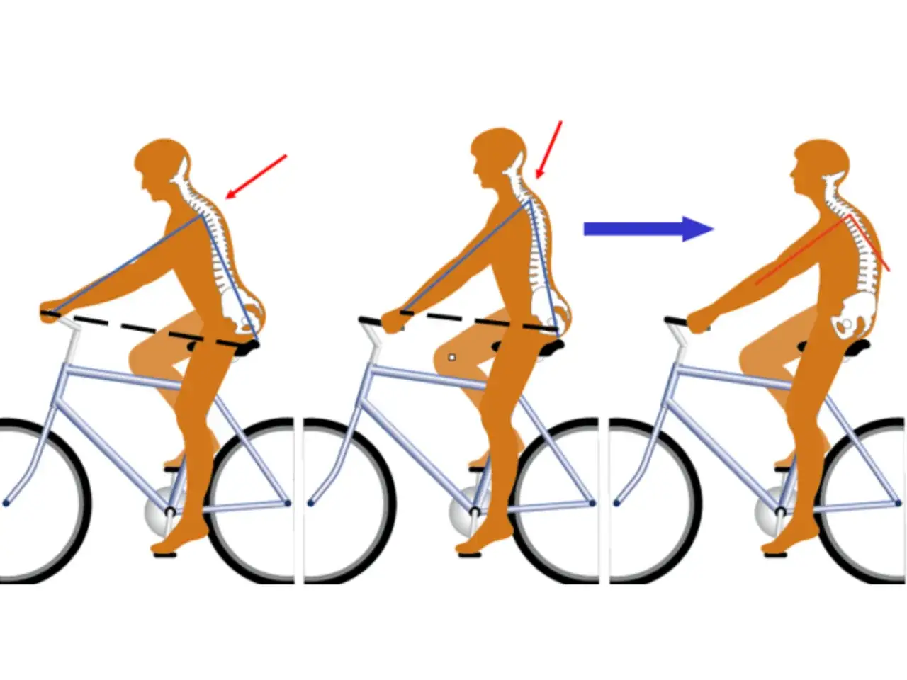 Optimale Haltung auf dem Fahrrad: Der richtige Abstand zwischen Sattel und Lenker f&uuml;r eine gesunde Wirbels&auml;ule.