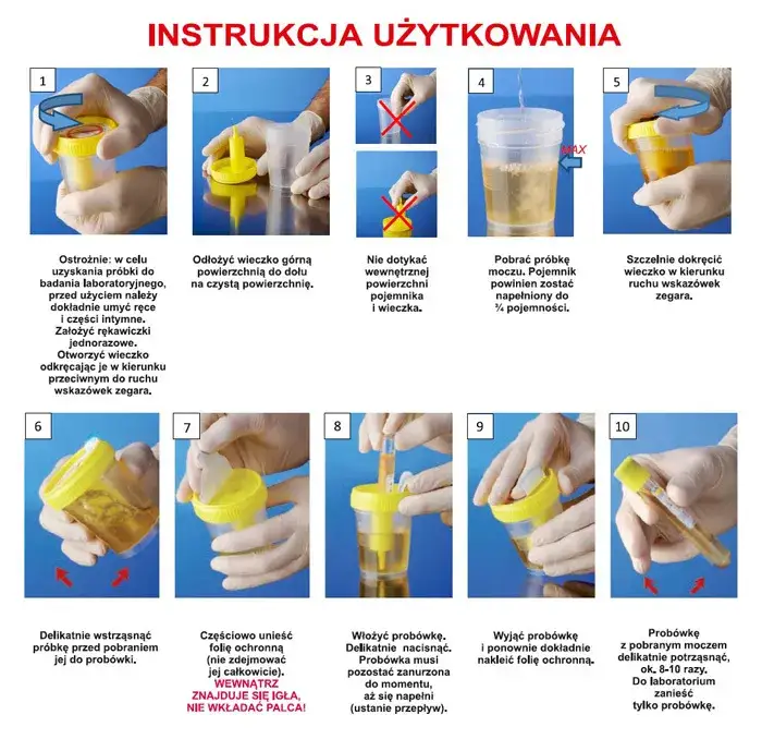 Pojemnik na mocz i próbka moczu