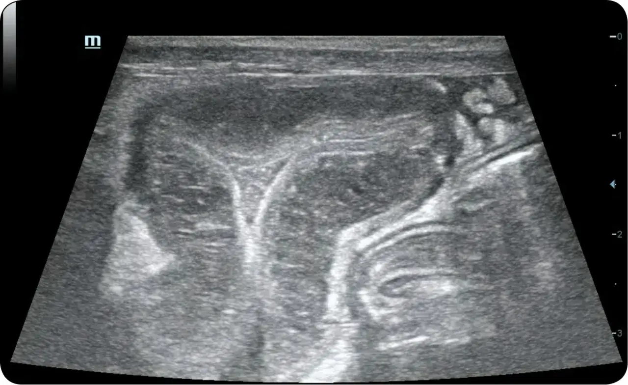Badanie USG jamy brzusznej psa, widoczne struktury jelitowe. Może być związane z diagnostyką problem&oacute;w z trawieniem, np. niedoborem lipazy.