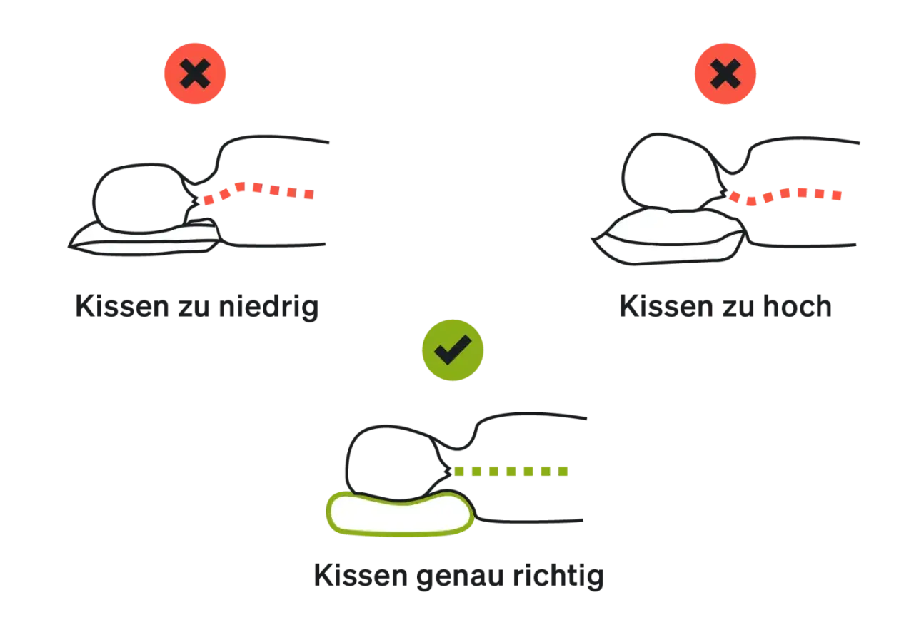 Illustrationen zeigen, wie eine falsche Kissenh&ouml;he zu einem Geierhals f&uuml;hrt. Das richtige Kissen st&uuml;tzt den Nacken optimal.