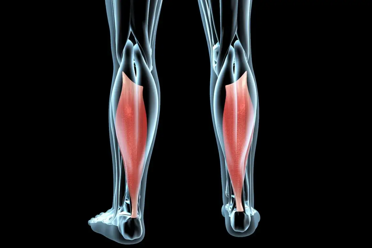 Vue anatomique des mollets, mettant en évidence les muscles rouges. Une douleur vive peut signaler un claquage musculaire.