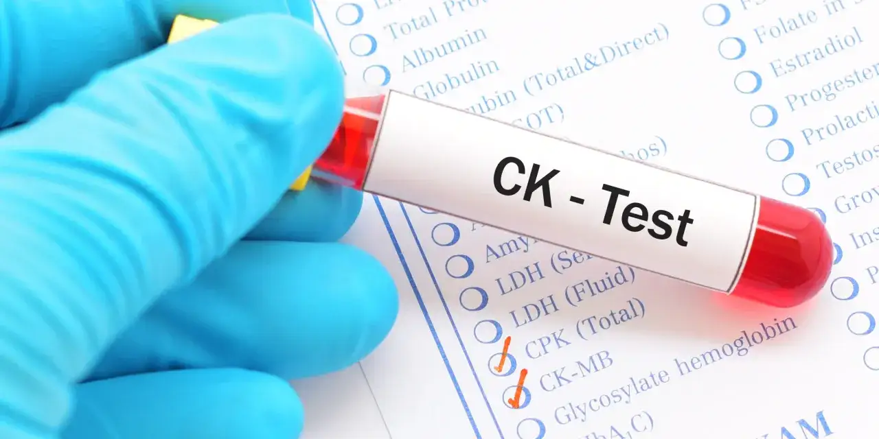 Ręka w niebieskiej rękawiczce trzyma probówkę z krwią do testu CK. Na liście badań zaznaczono CPK (Total) i CK-MB, czyli kinaza kreatynowa.