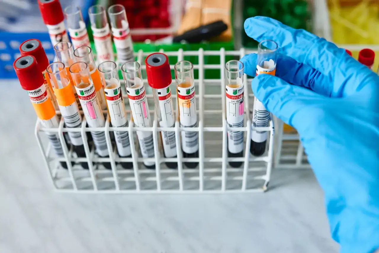 Ręka w niebieskiej rękawiczce wybiera probówkę z krwi. Ile się czeka na wyniki z krwi zależy od laboratorium.