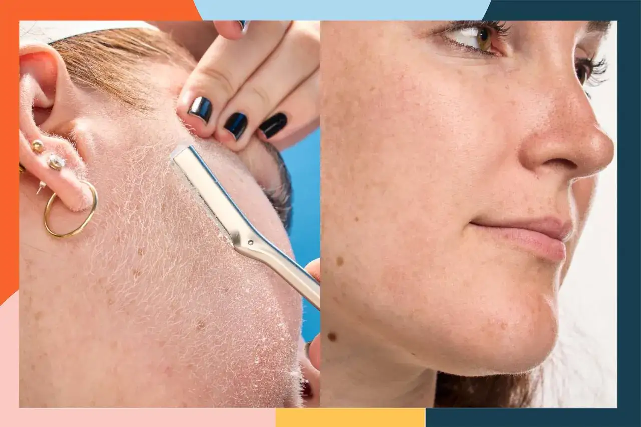 Dermaplaning for men: a close-up of a razor removing peach fuzz from a man's cheek, contrasted with smooth, clear skin.
