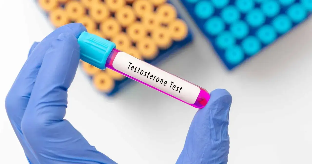 Zdjęcie Jak podnieść testosteron u kobiet - naturalne metody i skutki niskiego poziomu