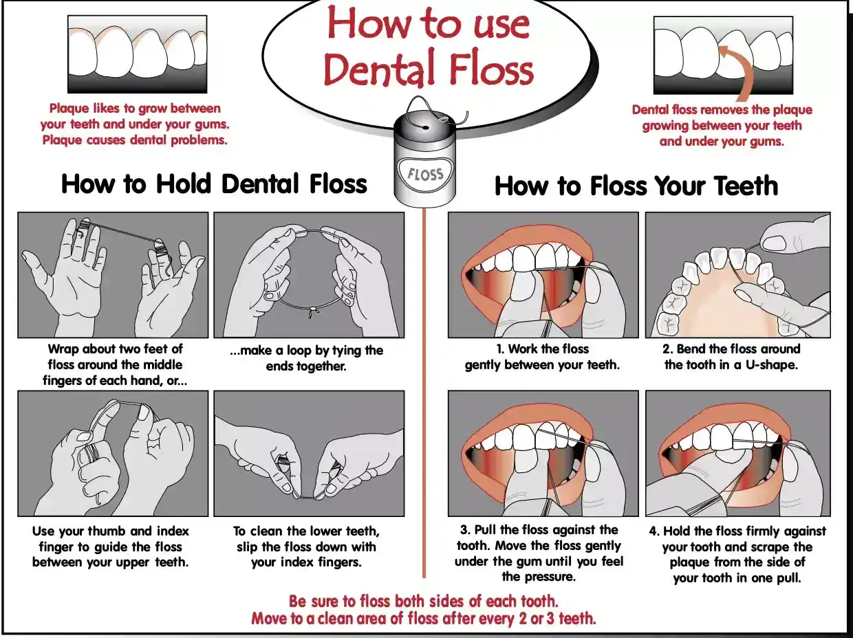 Guida illustrata su quante volte usare il filo interdentale per rimuovere la placca tra i denti e sotto le gengive.