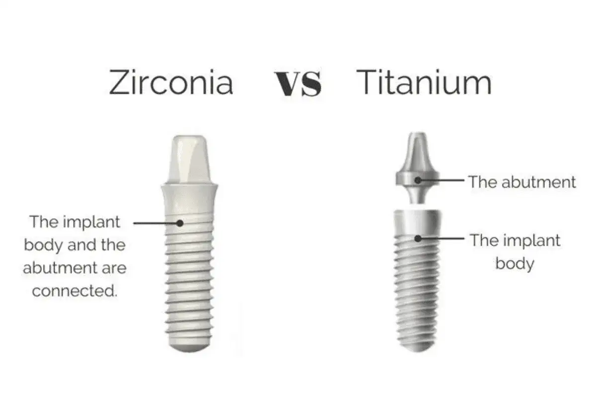 Porównanie rodzajów implantów zębowych: cyrkonowy (połączony implant z łącznikiem) i tytanowy (rozłączony implant z łącznikiem).