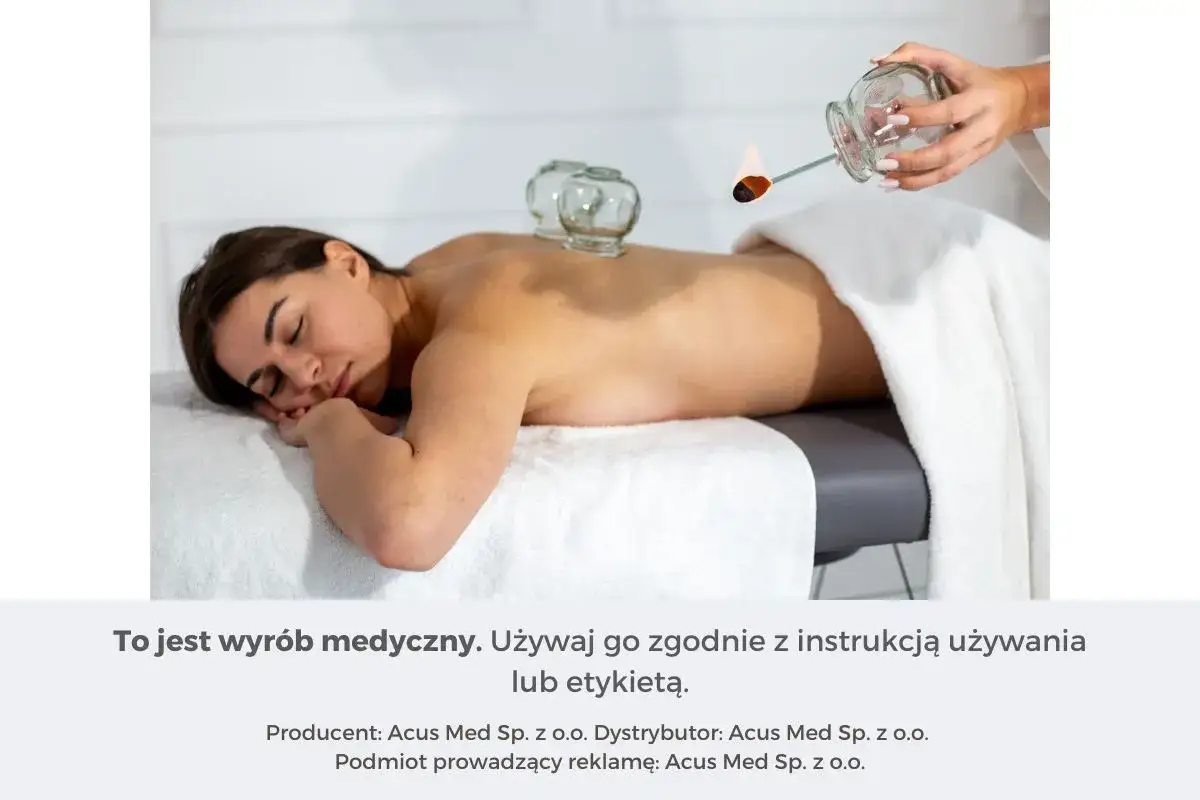 Kobieta leży na plecach, na których umieszczono szklane bańki. Zabieg bańkami na plecy.