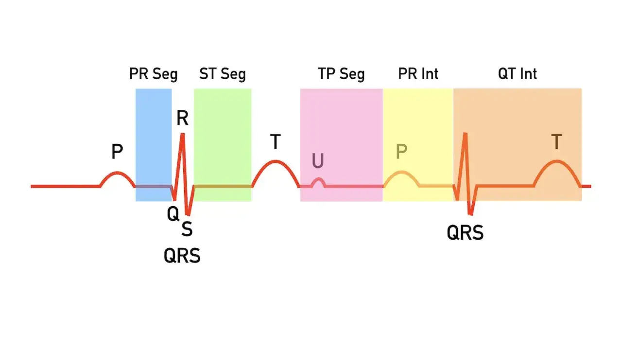 Schemat EKG z oznaczeniami fal (P, QRS, T, U) i odcinków (PR, ST, TP, QT). Pomaga zrozumieć, jak odczytać wynik EKG.