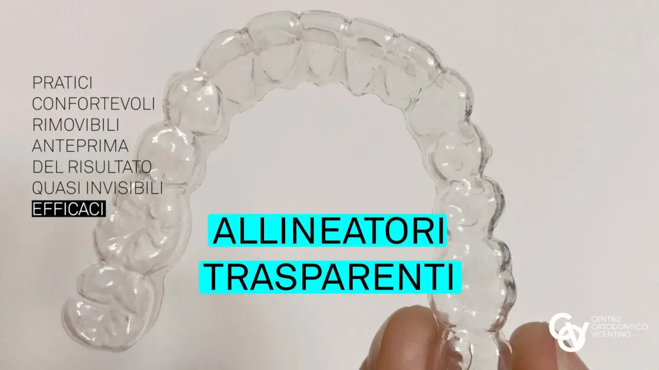Allineatori trasparenti, pratici e quasi invisibili. Dimentica il mal di testa da apparecchi tradizionali.