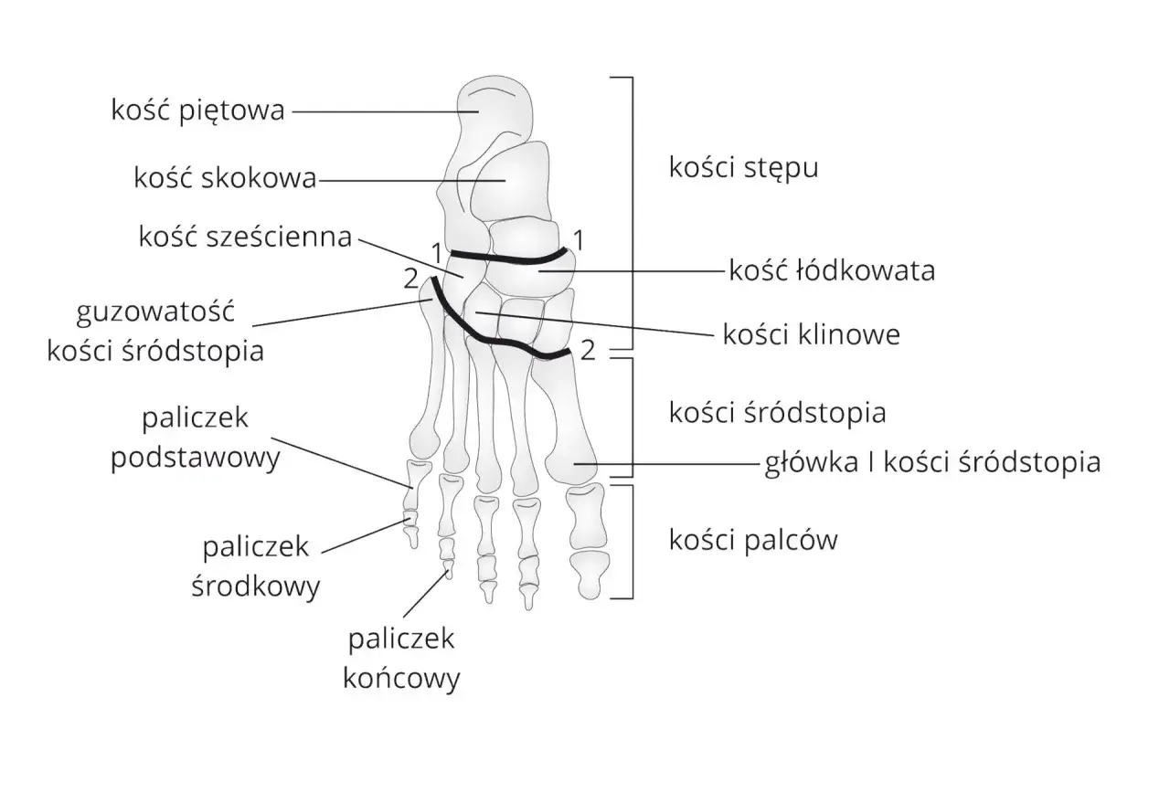 Anatomia stopy z zaznaczonymi kośćmi śródstopia, które mogą być przyczyną bólu śródstopia.