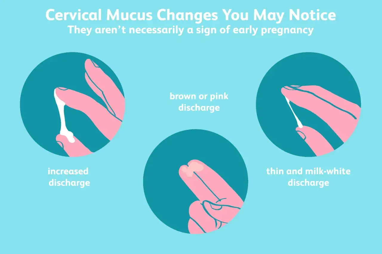 Ver&auml;nderungen des Zervixschleims: mehr Ausfluss, braun/rosa oder d&uuml;nn-milchig. Schleimiger Ausfluss ist nicht immer ein Schwangerschaftszeichen.