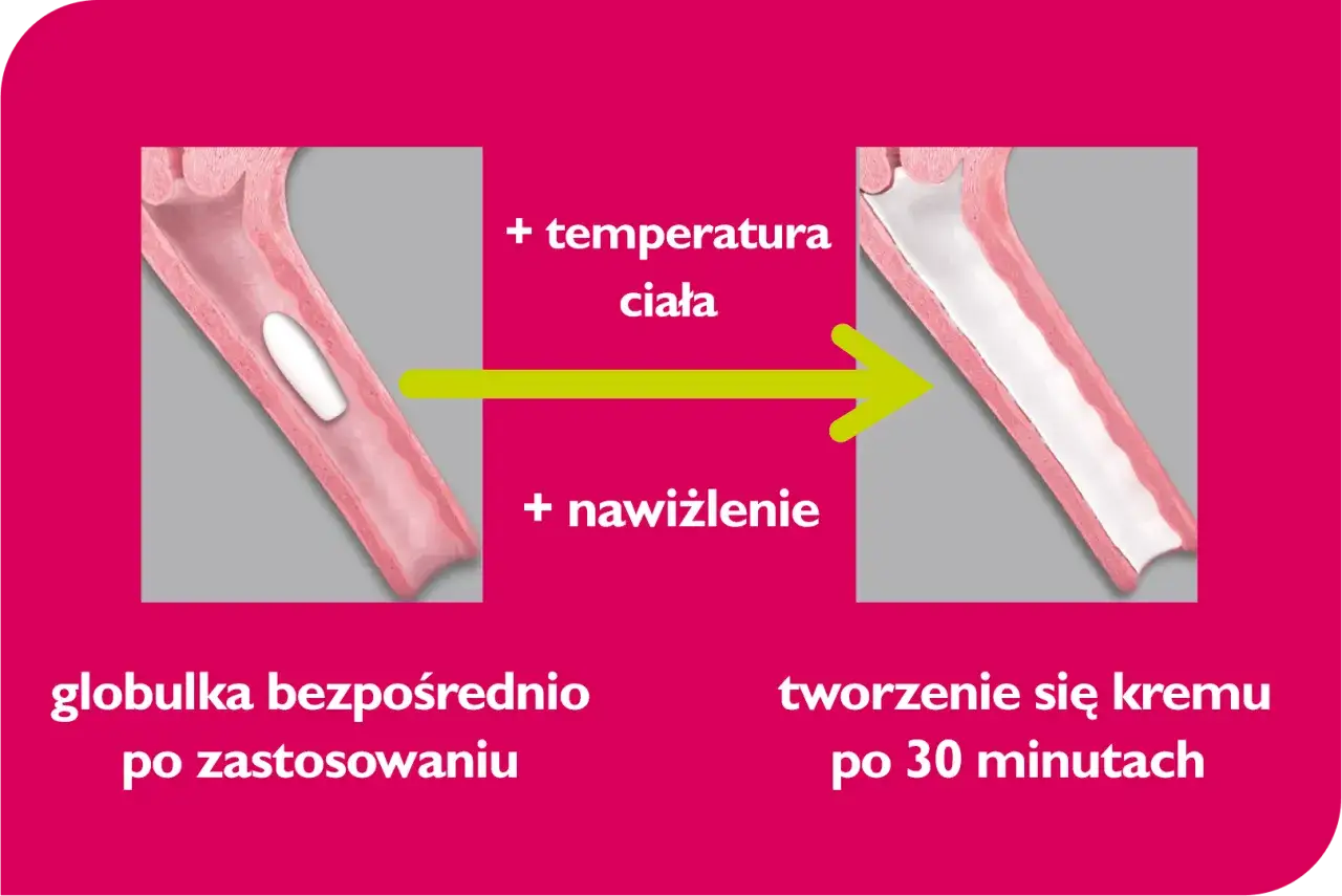 Globulka Cyclogest bezpośrednio po zastosowaniu, po 30 minutach tworzy się krem dzięki temperaturze ciała i nawilżeniu.