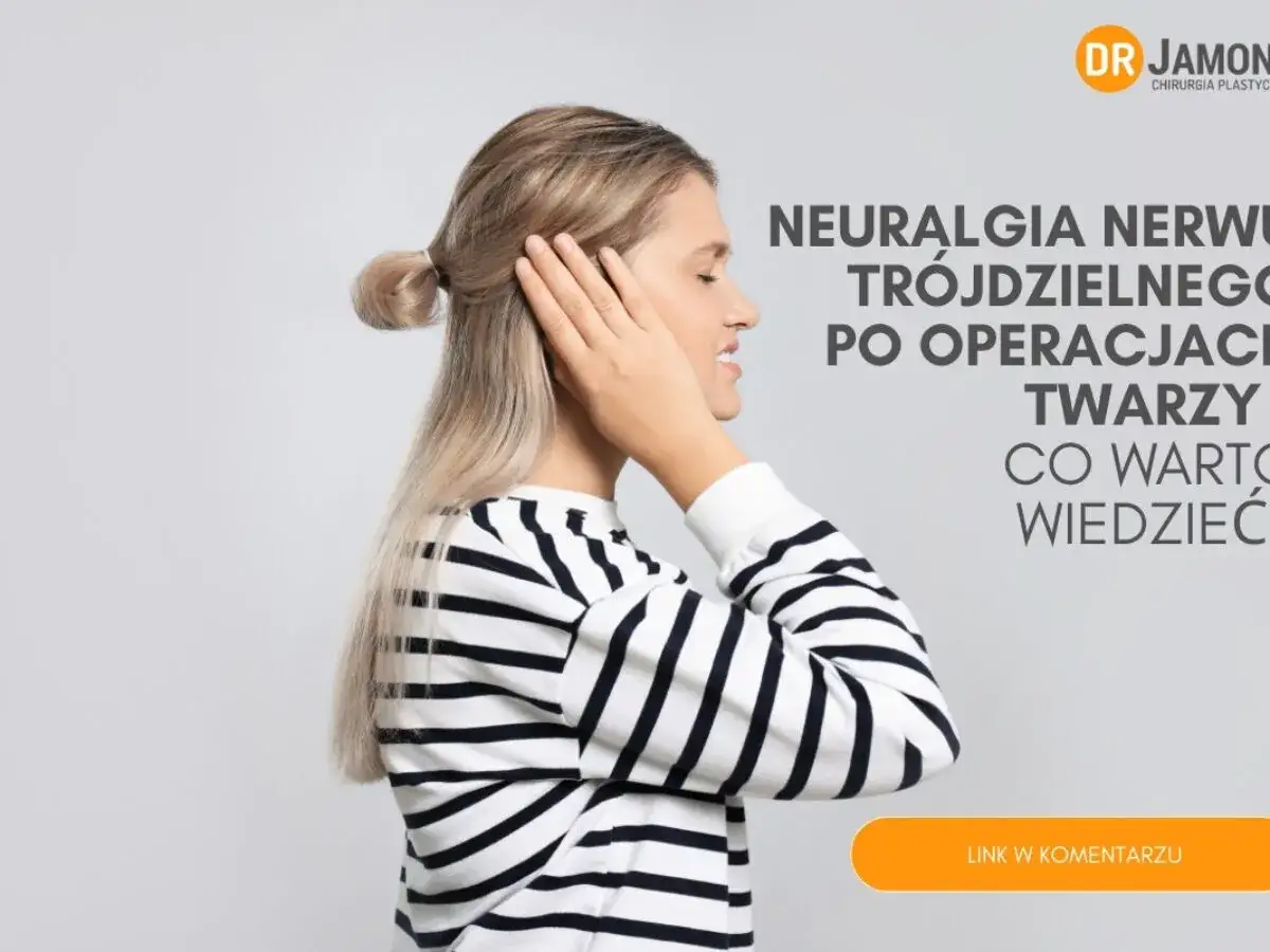 Kobieta z bólem twarzy, symbolizującym neuralgię nerwu trójdzielnego po operacji. Informacje o tym, co warto wiedzieć.