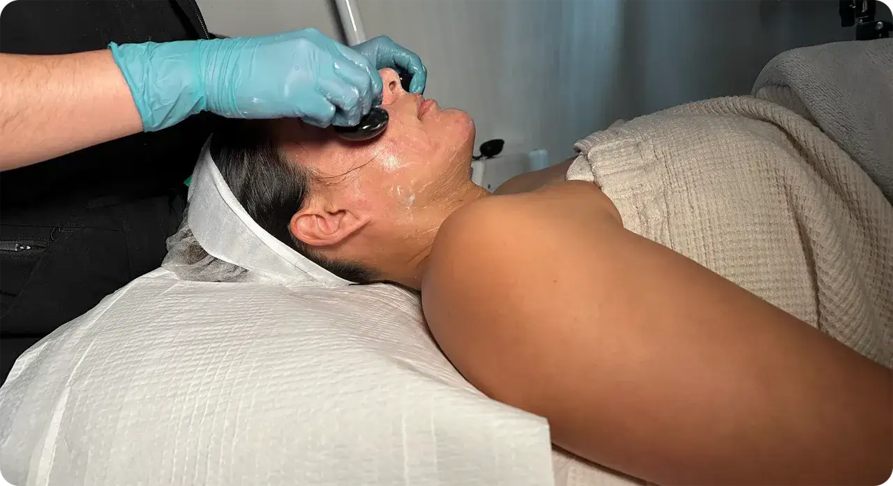 Tratamiento facial con ácido glicólico para eliminar manchas. Un profesional aplica una mascarilla en el rostro de una mujer.