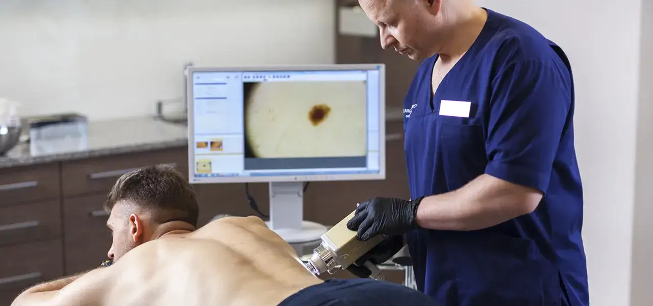 Dermatolog badający znamiona dermatoskopem